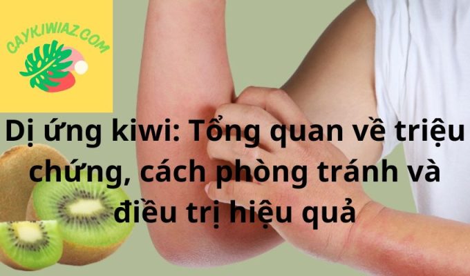 Dị ứng kiwi: Tổng quan về triệu chứng, cách phòng tránh và điều trị hiệu quả